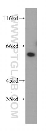 DOK1 Antibody in Western Blot (WB)