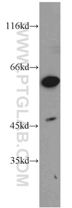 DOK1 Antibody in Western Blot (WB)