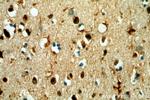 TCEA1 Antibody in Immunohistochemistry (Paraffin) (IHC (P))