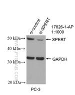 SPERT Antibody in Western Blot (WB)