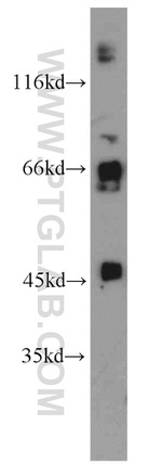 SPERT Antibody in Western Blot (WB)