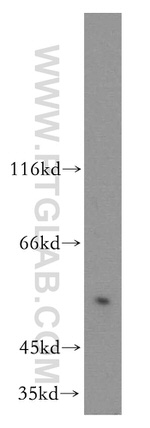SPERT Antibody in Western Blot (WB)