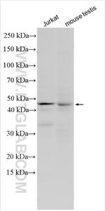 SLC35E2B Antibody in Western Blot (WB)