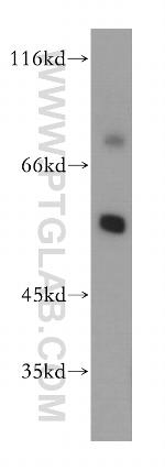 MGAT4C Antibody in Western Blot (WB)
