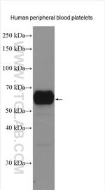 CD226 Antibody in Western Blot (WB)