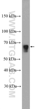 CHRNB2 Antibody in Western Blot (WB)