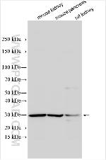 BDKRB2 Antibody in Western Blot (WB)