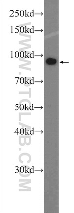 DDX10 Antibody in Western Blot (WB)