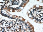 GCS1 Antibody in Immunohistochemistry (Paraffin) (IHC (P))