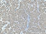 CYP2D6 Antibody in Immunohistochemistry (Paraffin) (IHC (P))