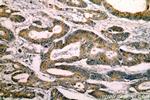 MGAT3 Antibody in Immunohistochemistry (Paraffin) (IHC (P))