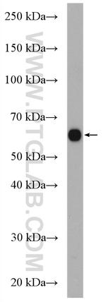 MGAT3 Antibody in Western Blot (WB)
