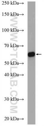 MGAT3 Antibody in Western Blot (WB)