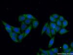 STS Antibody in Immunocytochemistry (ICC/IF)