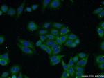 TP53INP1 Antibody in Immunocytochemistry (ICC/IF)