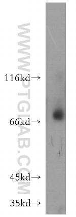 MMP8 Antibody in Western Blot (WB)