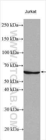 RANBP3L Antibody in Western Blot (WB)