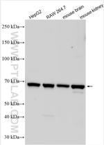 SLC6A18 Antibody in Western Blot (WB)