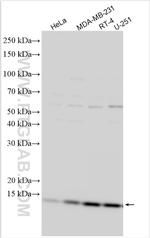 NDUFA11 Antibody in Western Blot (WB)