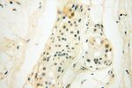 CAMSAP2 Antibody in Immunohistochemistry (Paraffin) (IHC (P))