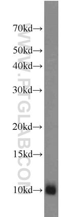 MPV17L Antibody in Western Blot (WB)