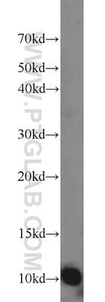 MPV17L Antibody in Western Blot (WB)