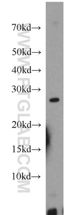 MXD1 Antibody in Western Blot (WB)