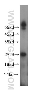 MXD1 Antibody in Western Blot (WB)