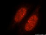 SLTM Antibody in Immunocytochemistry (ICC/IF)