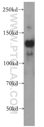 SLTM Antibody in Western Blot (WB)