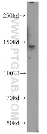 SLTM Antibody in Western Blot (WB)