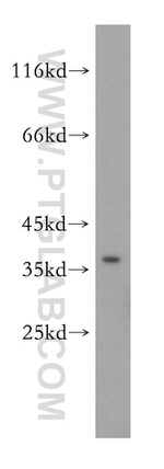 KCNAB2 Antibody in Western Blot (WB)