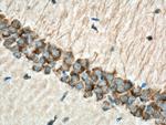KCNAB2 Antibody in Immunohistochemistry (Paraffin) (IHC (P))
