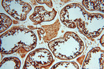 CTTNBP2 Antibody in Immunohistochemistry (Paraffin) (IHC (P))