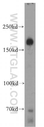 CTTNBP2 Antibody in Western Blot (WB)