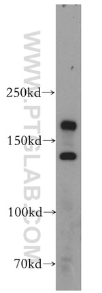 CTTNBP2 Antibody in Western Blot (WB)
