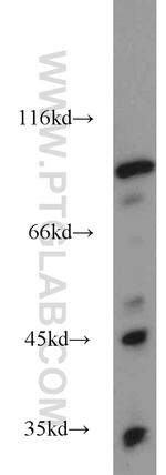 Opticin Antibody in Western Blot (WB)