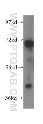 Opticin Antibody in Western Blot (WB)