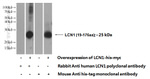 LCN1 Antibody in Western Blot (WB)