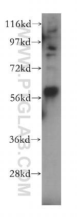 LPCAT4 Antibody in Western Blot (WB)