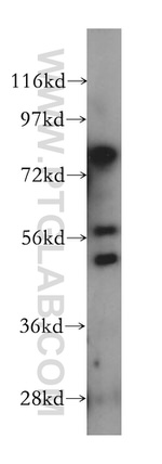 LPCAT4 Antibody in Western Blot (WB)