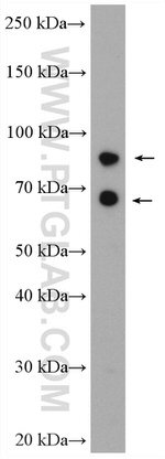 AP1G2 Antibody in Western Blot (WB)