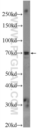 AP1G2 Antibody in Western Blot (WB)