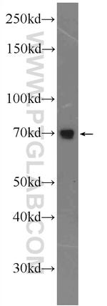 AP1G2 Antibody in Western Blot (WB)