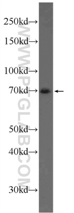 AP1G2 Antibody in Western Blot (WB)