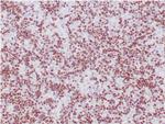 TdT/DNA Nucleotidylexotransferase Monoclonal Antibody (TDT, 1393)