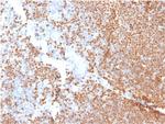 TdT/DNA Nucleotidylexotransferase (Acute Lymphoblastic Leukemia Marker) Monoclonal Antibody (DNTT/1453)