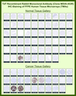TdT/DNA Nucleotidylexotransferase (Acute Lymphoblastic Leukemia Marker) Recombinant Rabbit Monoclonal Antibody (MSVA-453R)