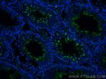 PLAC9 Antibody in Immunohistochemistry (PFA fixed) (IHC (PFA))