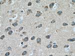 ADPRH Antibody in Immunohistochemistry (Paraffin) (IHC (P))